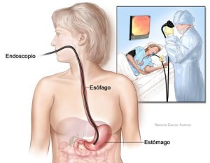 endoscopia