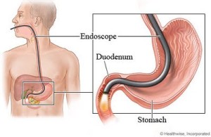 endoscopia2